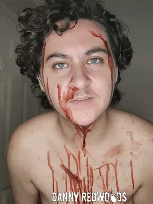 Gif of a young white trans guy with curly brown hair and grey eyes. He's got some (fake) wounds and (fake) blood all over his face, neck, and chest. He makes eye contact with the camera and snarls/chomps at it, baring his teeth. Then he lowers his chin and grins wide.